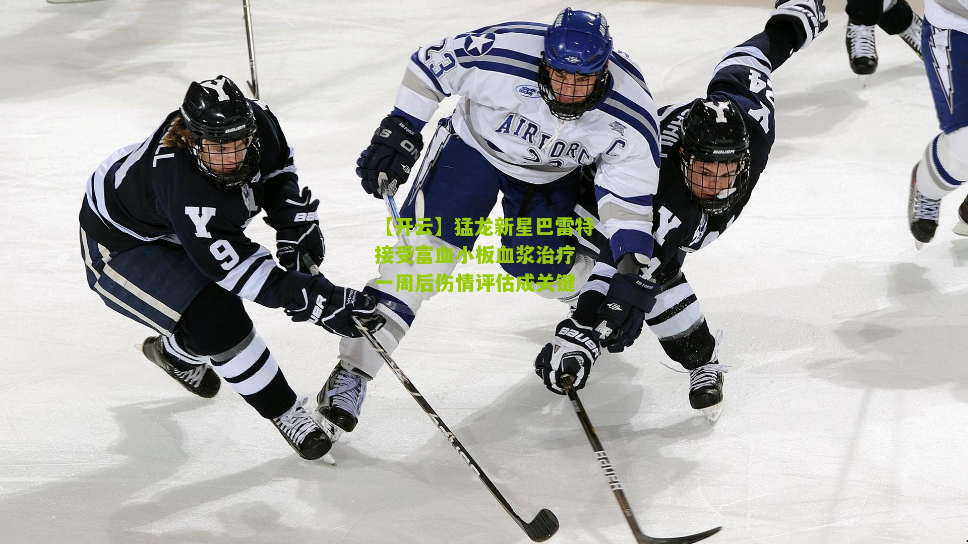 猛龙新星巴雷特接受富血小板血浆治疗 一周后伤情评估成关键